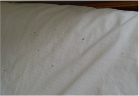 Early Signs To Look For In A Bed Bug Inspection
